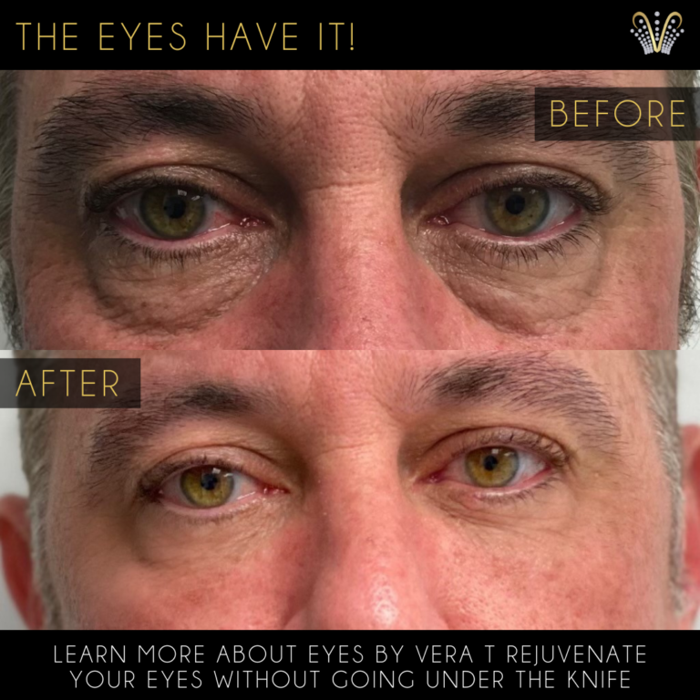 Eyes by Vera Blog